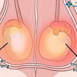 Viêm tinh hoàn là gì? Cách chữa trị hiệu quả giúp nam giới lấy lại tự tin nam giới