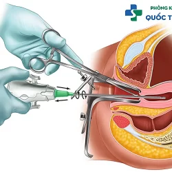 Giải đáp: Vì sao nên chọn bác sĩ phá thai của phòng khám Việt Sing?