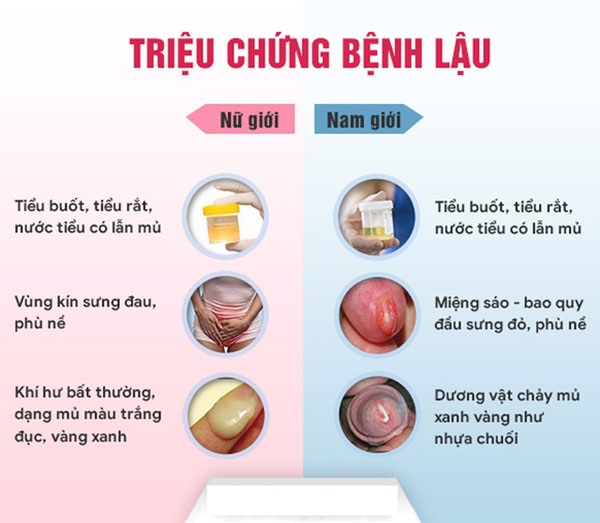 Danh sách Top 10 địa chỉ phòng khám chữa bệnh lậu tại Bắc Ninh uy tín 2026