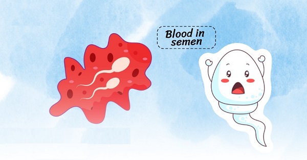 Chữa xuất tinh ra máu Bắc Ninh – Giải tỏa nỗi ám ảnh thầm kín của nam giới